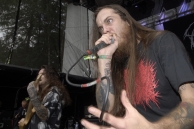VULVODYNIA